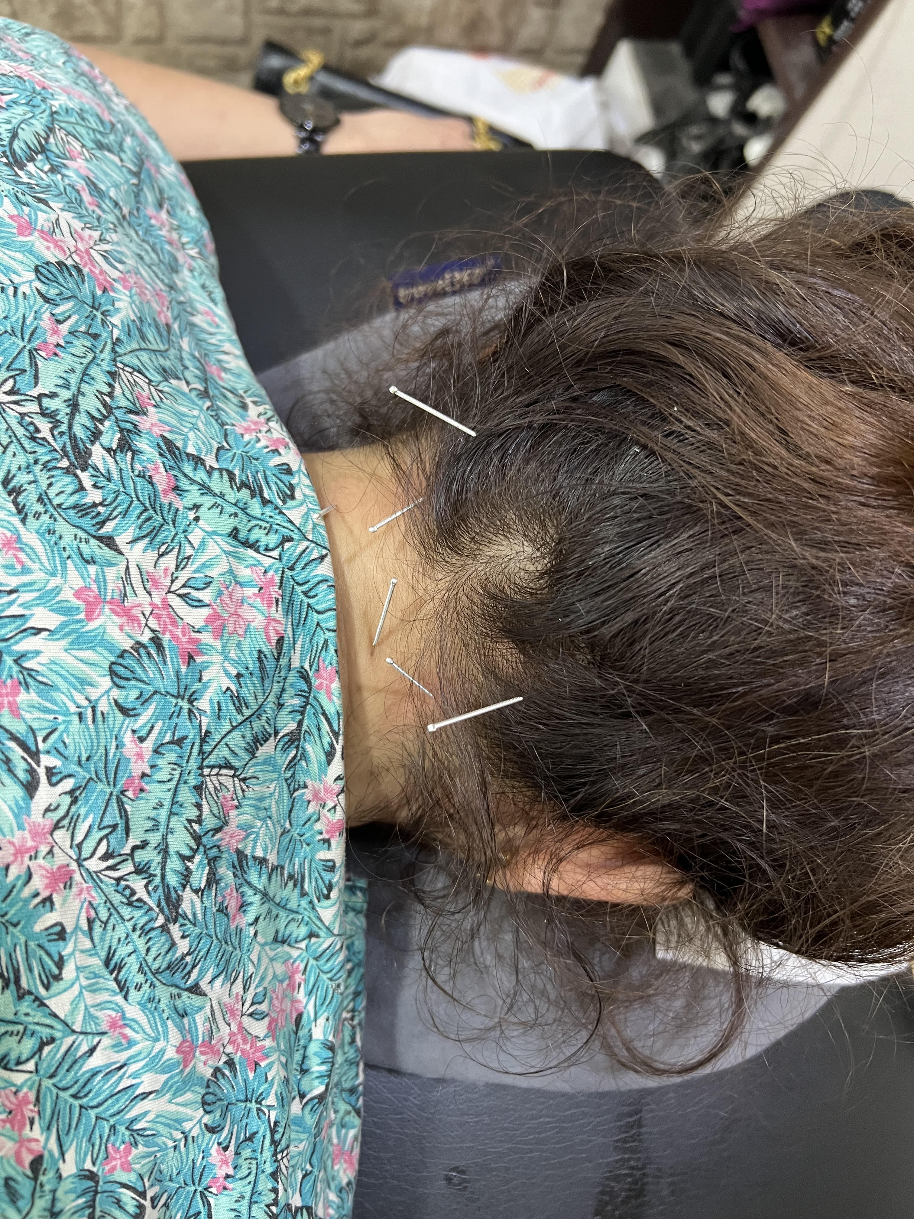 Lumbar Spine Joint Mobilization
