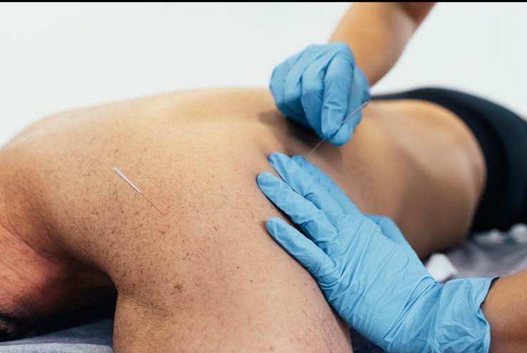 Advanced Dry Needling & Muscle Recovery